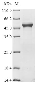 Recombinant Human Selenide, water dikinase 2 (SEPHS2) (U60S)