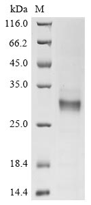 Recombinant Human G-protein coupled receptor 84 (GPR84), partial