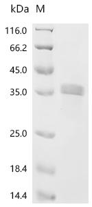 Recombinant Mouse Nephrin (Nphs1), partial