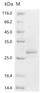 Recombinant Mouse Gamma-interferon-inducible lysosomal thiol reductase (Ifi30)