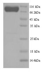 Recombinant Human E3 ubiquitin-protein ligase SMURF2 (SMURF2)
