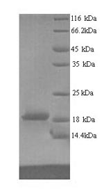 Recombinant Human Ribonucleoprotein PTB-binding 2 (RAVER2), partial