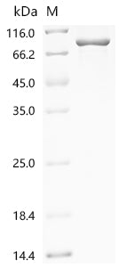 Recombinant Human Junctional cadherin 5-associated protein (JCAD), partial