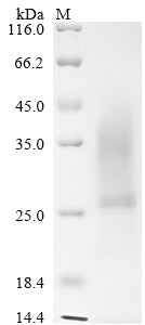 Recombinant Mouse Collagen triple helix repeat-containing protein 1 (Cthrc1)