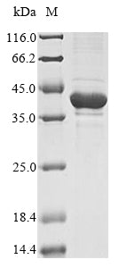 Recombinant Arabidopsis thaliana Beta-amylase 1, chloroplastic (BAM1), partial