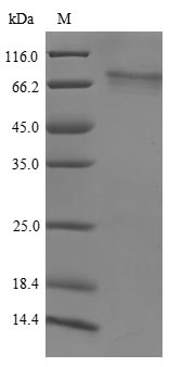 Recombinant Human Histone-lysine N-methyltransferase NSD3 (NSD3)