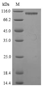 Recombinant Mouse Pancreatic secretory granule membrane major glycoprotein GP2 (Gp2)