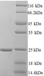 Recombinant Human Hematological and neurological expressed 1 protein (HN1)