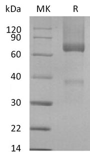Recombinant Rhesus Macaque GPC3 (C-6His)