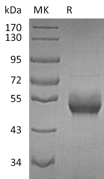 Recombinant Human B4GALT1 (C-6His)