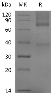 Recombinant Mouse GPC3 (C-6His)