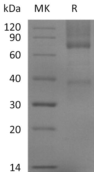 Recombinant Mouse GPC3 (C-6His)