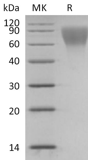 Recombinant Human CD34 (C-6His)