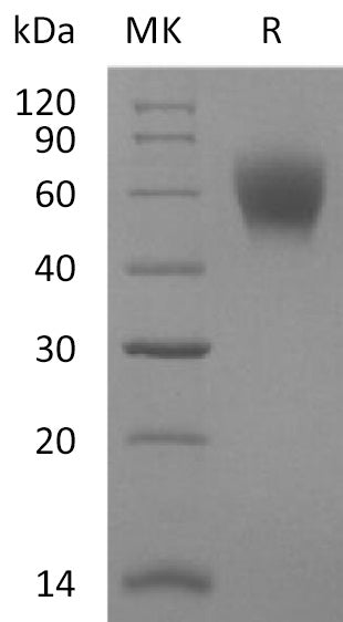 Recombinant Mouse 5T4 (C-6His)