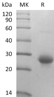 Recombinant Mouse CD27L (N-10His)