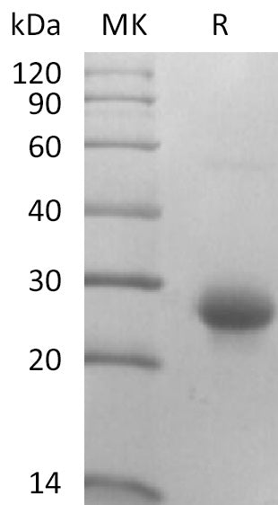 Recombinant Mouse CD27L (N-10His)