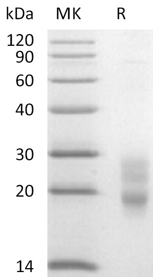 Recombinant Mouse CD7 (C-6His)