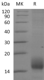 Recombinant Cynomolgus BCMA (C-6His)