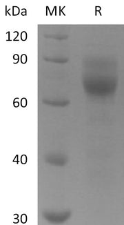 Recombinant Human AXL (C-6His)