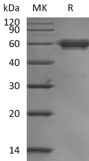 Recombinant Human LAIR1 (C-mFc)