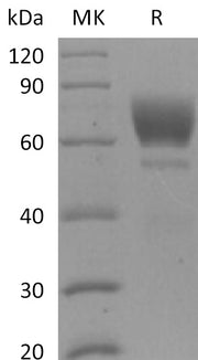 Recombinant Mouse AXL (C-6His)