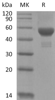 Recombinant Human Carbonic Anhydrase 9 (C-6His)