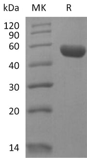 Recombinant Human LAIR2 (C-Fc)