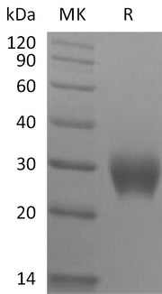 Recombinant Rhesus Macaque LAIR1 (C-6His)