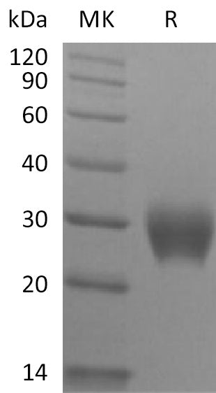 Recombinant Rhesus Macaque LAIR1 (C-6His)