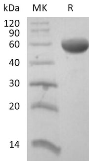 Recombinant Human CD8B (C-Fc)
