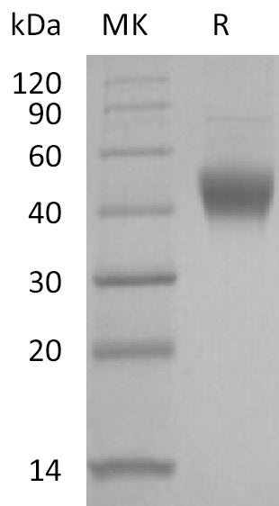 Recombinant Human IL-7RA (C-6His)