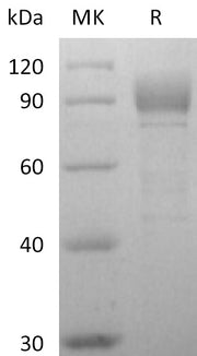 Recombinant Human Otolin-1 (C-6His)