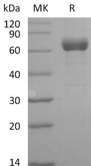 Recombinant Human ANGPTL3 (C-Fc)