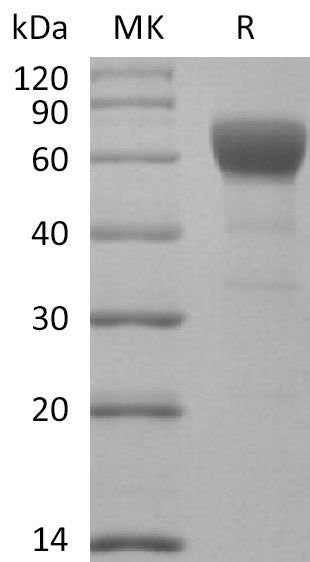 Recombinant Mouse TGFBR2 (C-Fc)