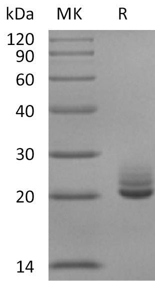Recombinant Mouse FGF-21 (C-6His)