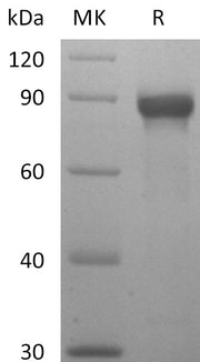 Recombinant Human Siglec-8 (C-mFc)