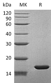 Recombinant Human FABP7 (N-6His)