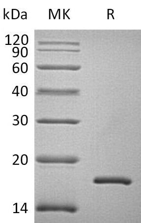 Recombinant Human FABP2 (N, C-6His)