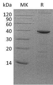 Recombinant Human FBPase1 (C-6His, E. coli)