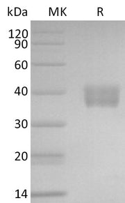 Recombinant Mouse IL-17RE (C-6His)