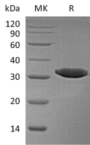 Recombinant Human Esterase D (C-6His)