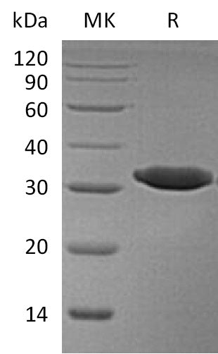 Recombinant Human Esterase D (C-6His)