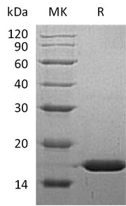 Recombinant Human FABP5 (N-6His)