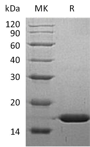 Recombinant Human FABP5 (N-6His)