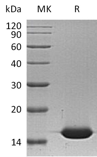 Recombinant Human FABP1 (N-6His)