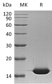 Recombinant Human FABP1 (N-6His)