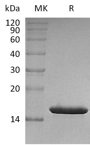 Recombinant Human FABP4 (N-6His)