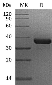 Recombinant Human OGG1
