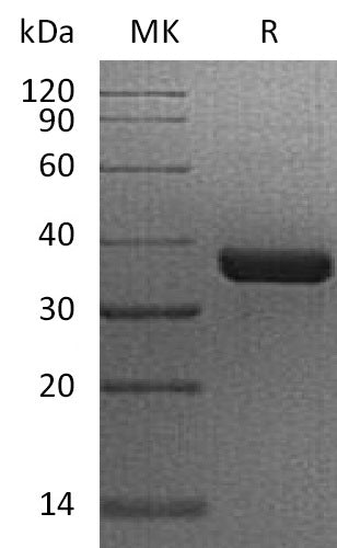 Recombinant Human OGG1