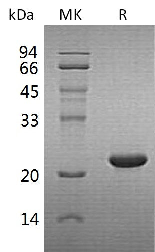 Recombinant Human CYGB (C-6His)